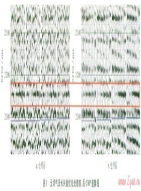 四川盆地元壩氣田超深層礁灘氣藏儲層氣水識別技術(shù)